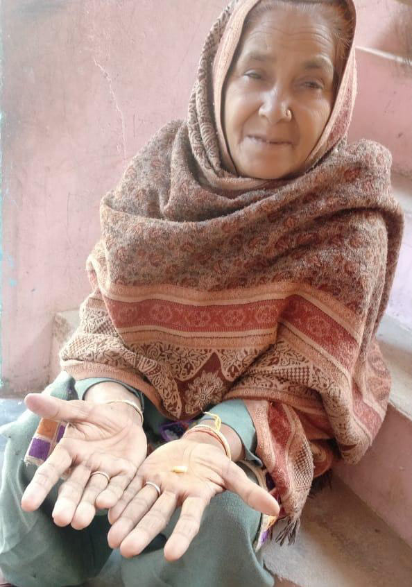 The police took a minor action, the soldier's mother reached the SP court with a broken tooth