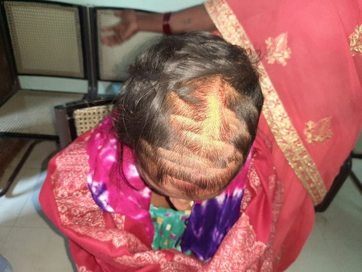 girlfriend attack on bride of his boyfriend just after marriage in Nalanda Bihar