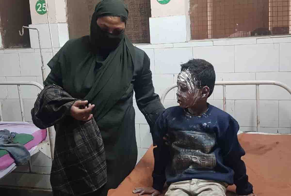 Farrukhabad: Children set fire by collecting ammo from firecrackers, five scorched in explosion, hospitalized