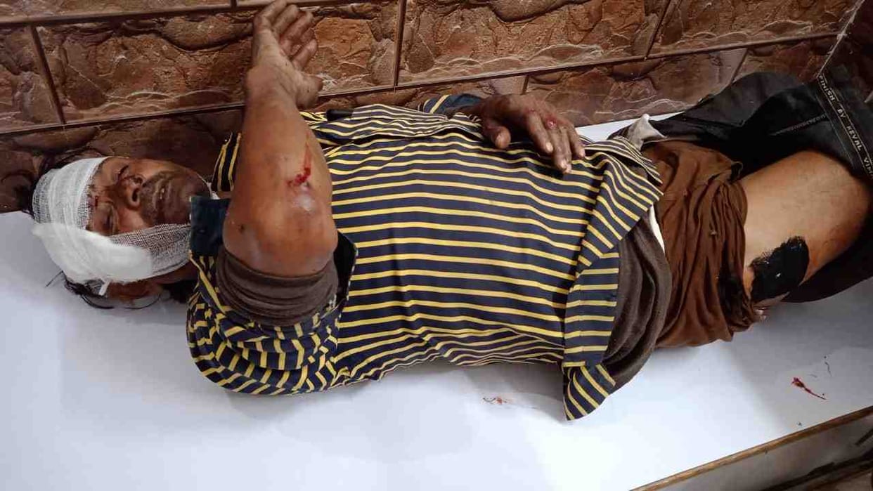 Uncontrolled auto collides, five injured