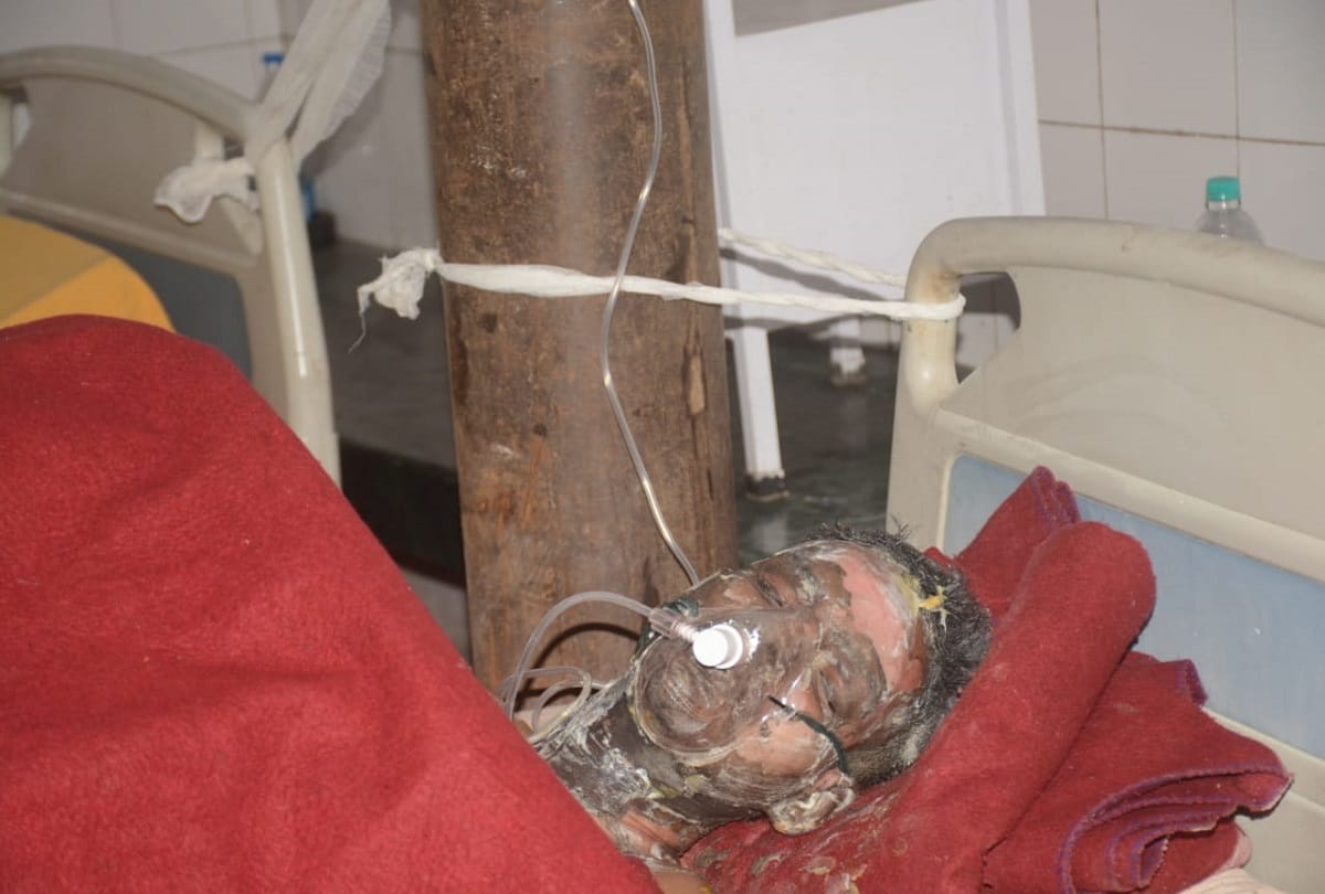 man attempting self immolation outside ssp house in moradabad मुरादाबाद।