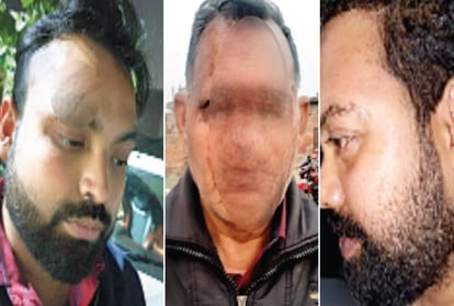 clash between electricians and consumer, six injured in lucknow