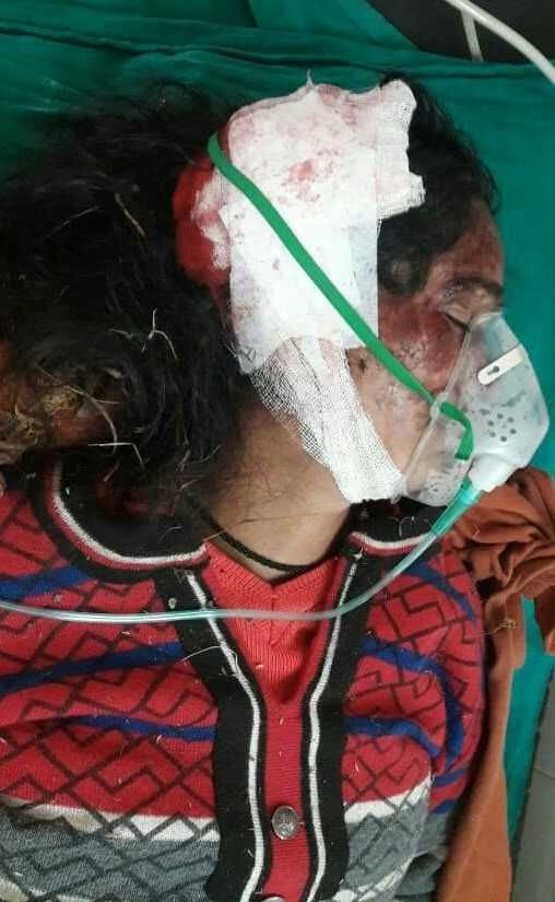 Five injured including a child in a pig attack in Tilsari