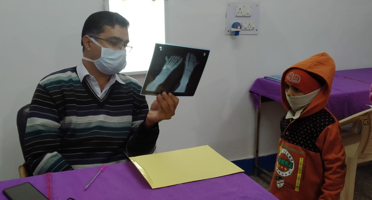 Foot clinic service started in civil hospital, children will have free treatment of crooked legs
