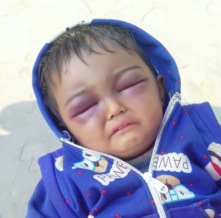 Could not bear the cost of treatment, the village returned with innocent