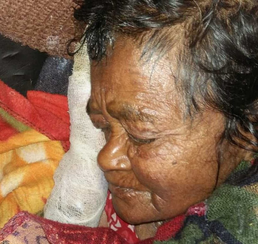 70-year-old elderly scorch caught in flames