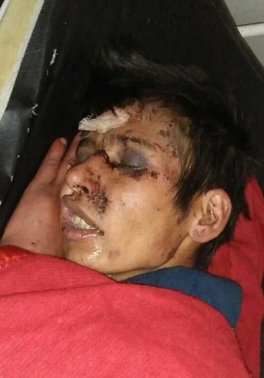 young man who was found injured nine days ago is referred to Haldwani