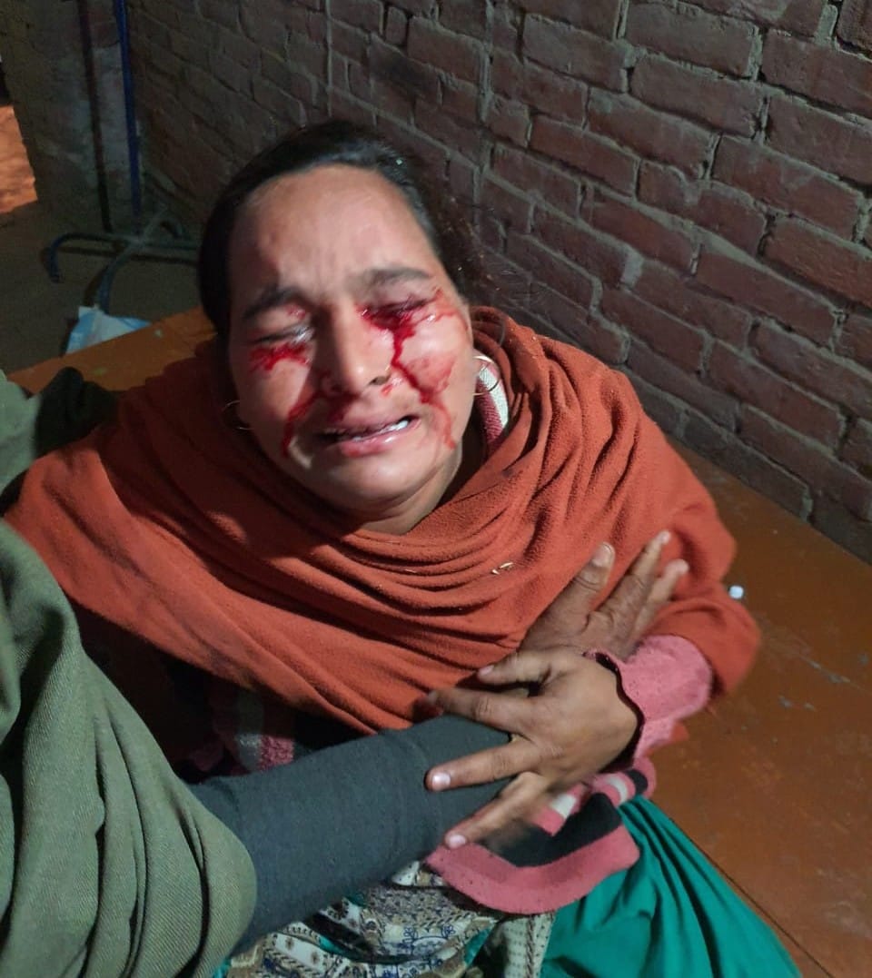 Woman went to complain, severe eye injury