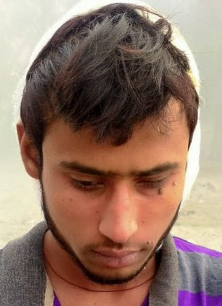 Serviceman's head boils after stopping from killing fish
