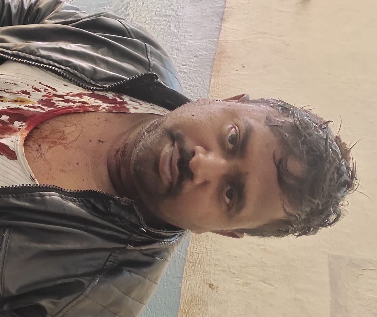 Attack with sharp-edged weapon, three injured brothers injured