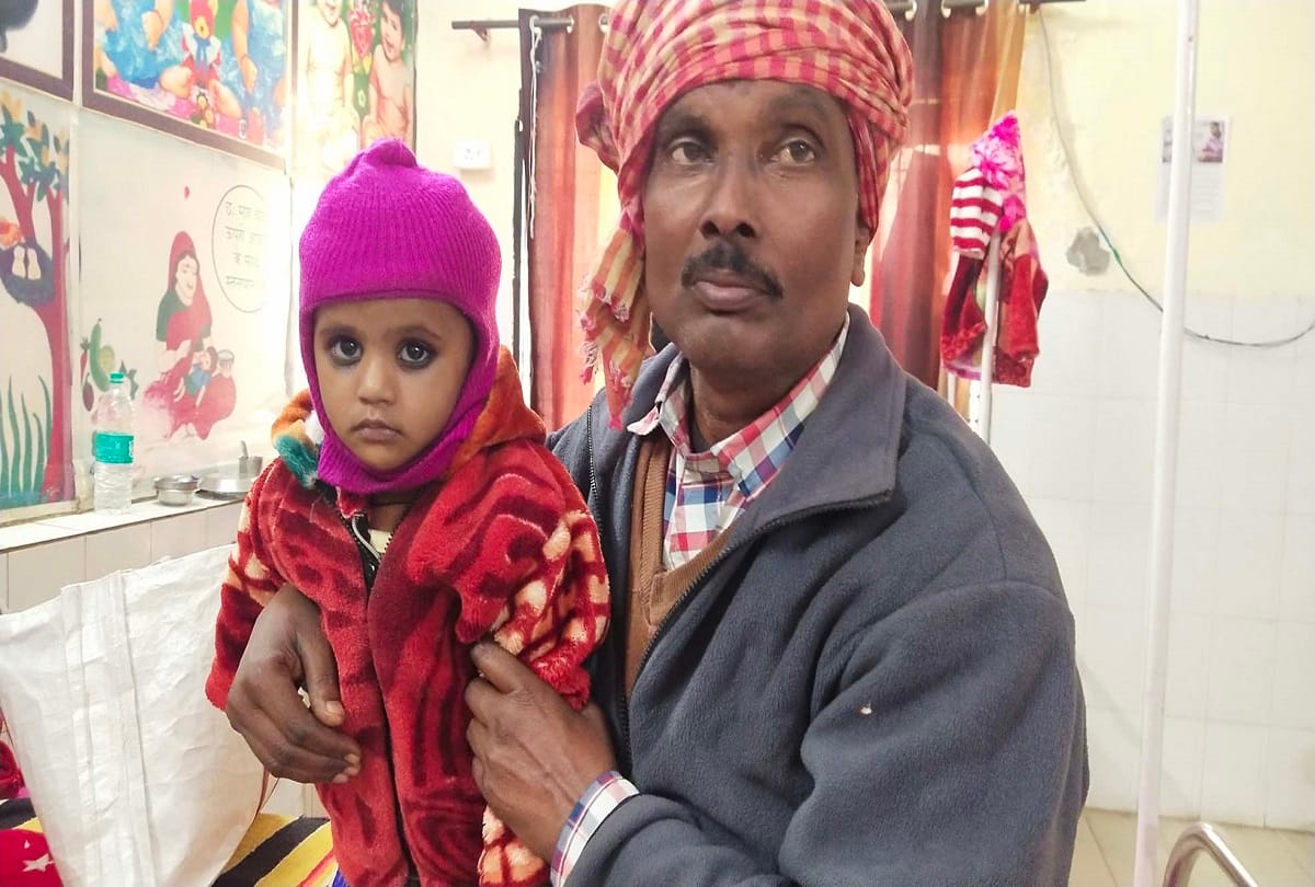 पोषण पुनर्वास केंद्र में पिता की गोद मे अचलगंज की आराध्या, जिसमें कुपोषण के तीनों लक्षण हैं