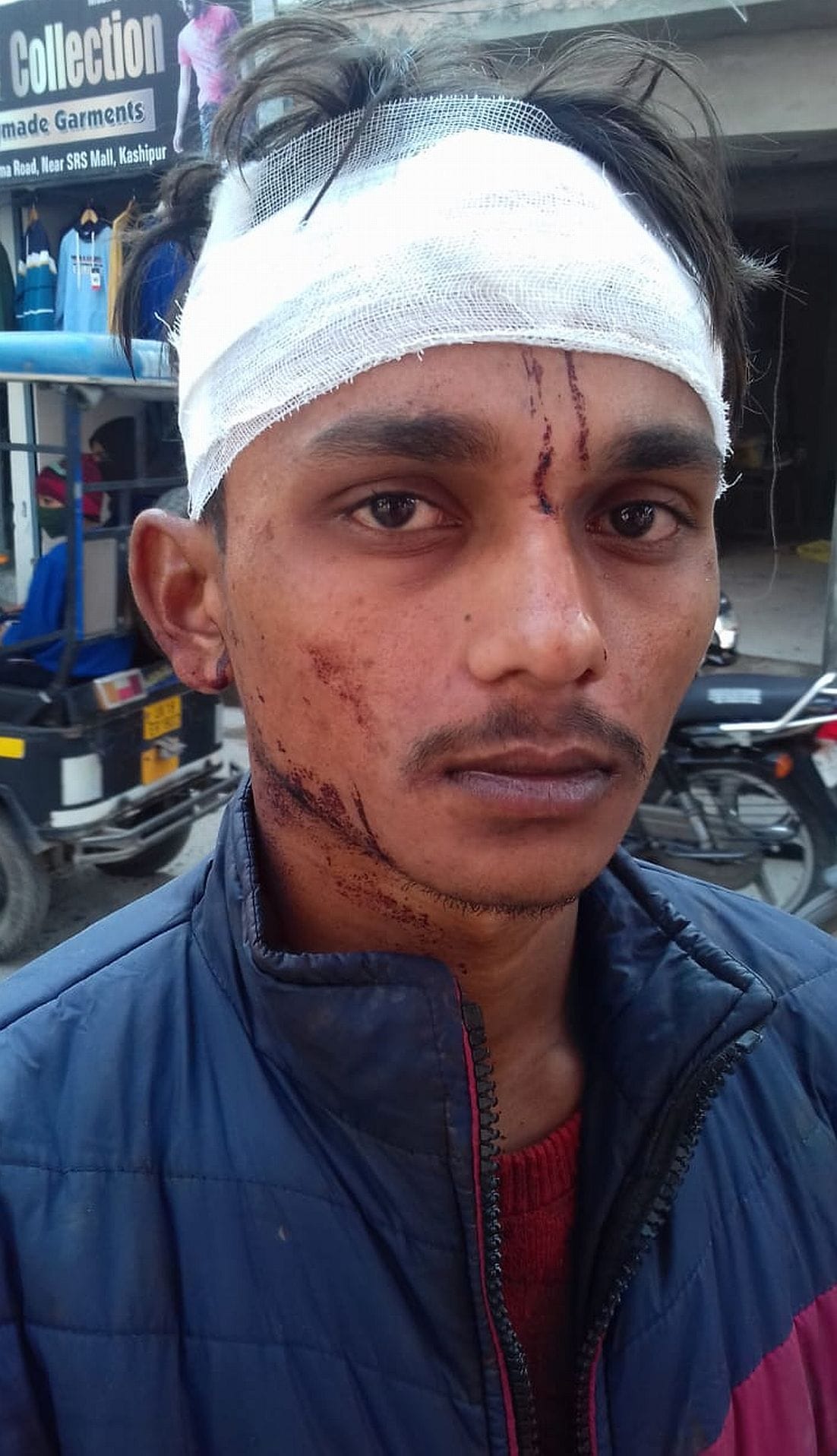 Army soldier breaks the head of mother, wife also supports, case on both