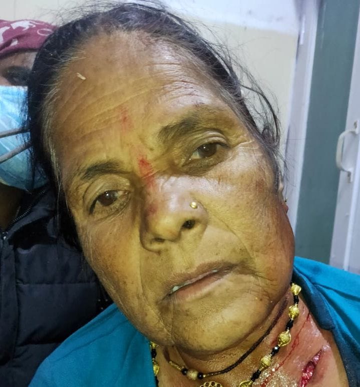 Leopard injured woman in Kapadigaon, Kanalichina