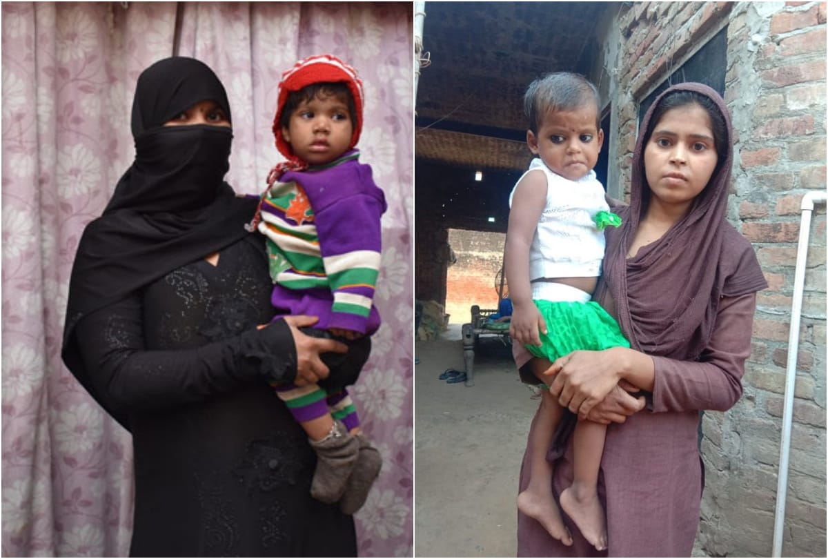 कुपोषित बच्चे के साथ उसकी मां
