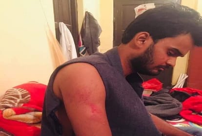 Stones in two groups of Allahabad University and competitive students, one student shot in firing