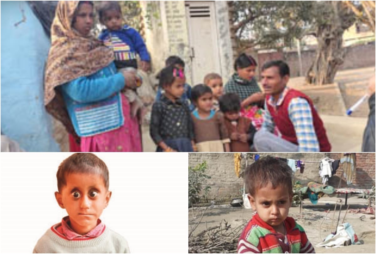 ग्राम पंचायत दनियापुर शंकरपुर में एक ही परिवार में चार बच्चे अतिकुपोषित