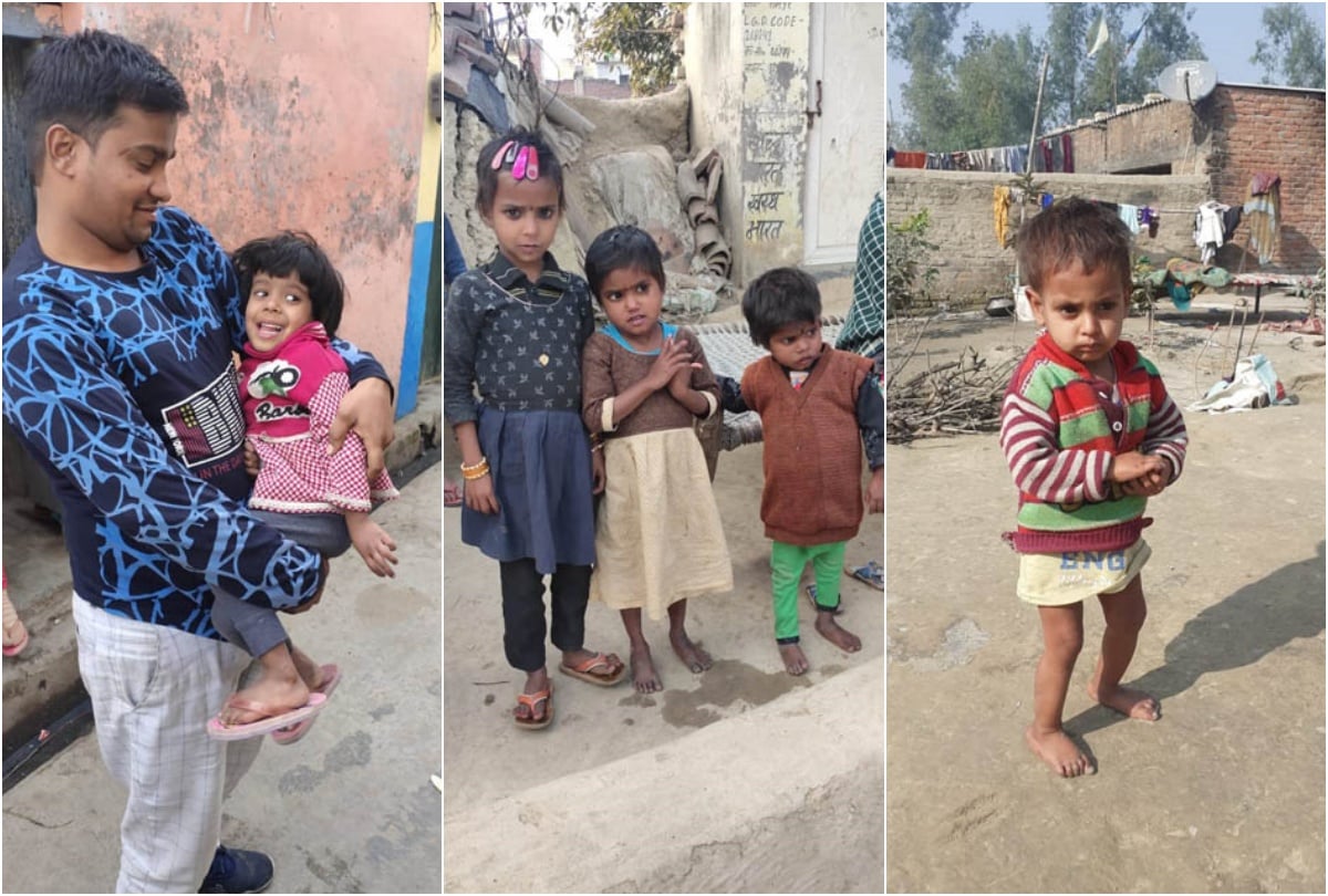 कुपोषण के शिकार बच्चे