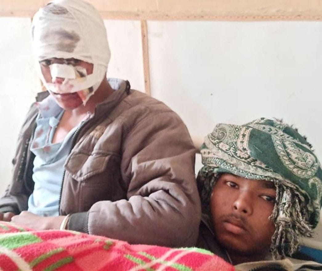 Hathras: Bolero trampled four students returning from tuition, one in critical condition