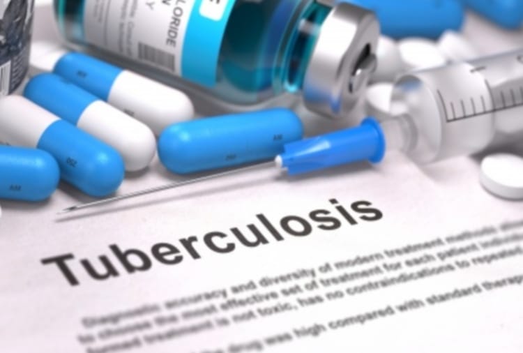 TB patients not reaching hospitals in Punjab