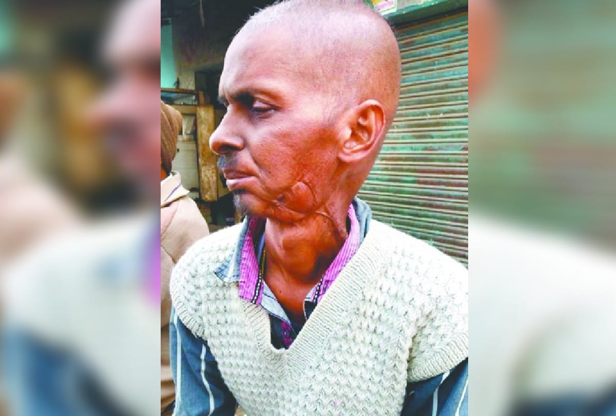Father Sufferd From Cancer Daughter Starts Business Selling Sweets And Samosa