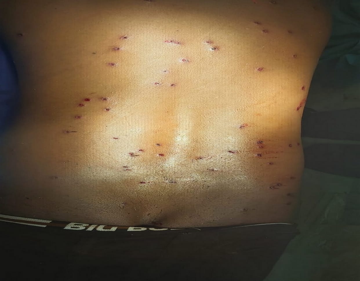 UP: Shot in land dispute, a young man badly injured