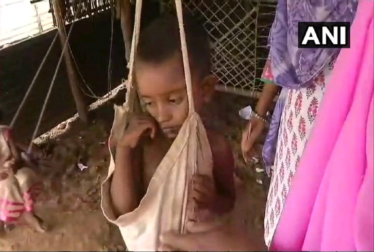 70 thousand kids down with acute malnutrition in Madhya Pradesh