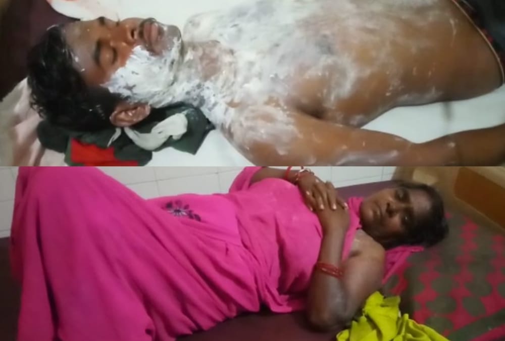 Boiled oil poured on a lady and her grand son in Sultanpur.