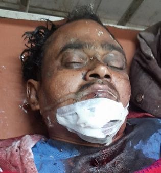Middle-aged man found in a moribund condition in the field
