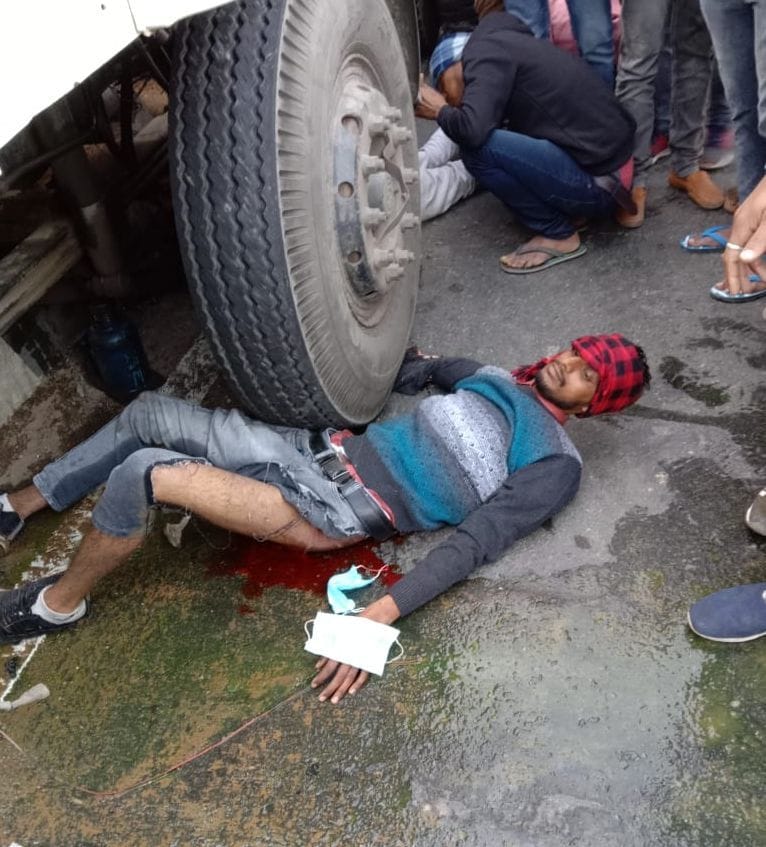 Youth riding bike injured in trailer collision