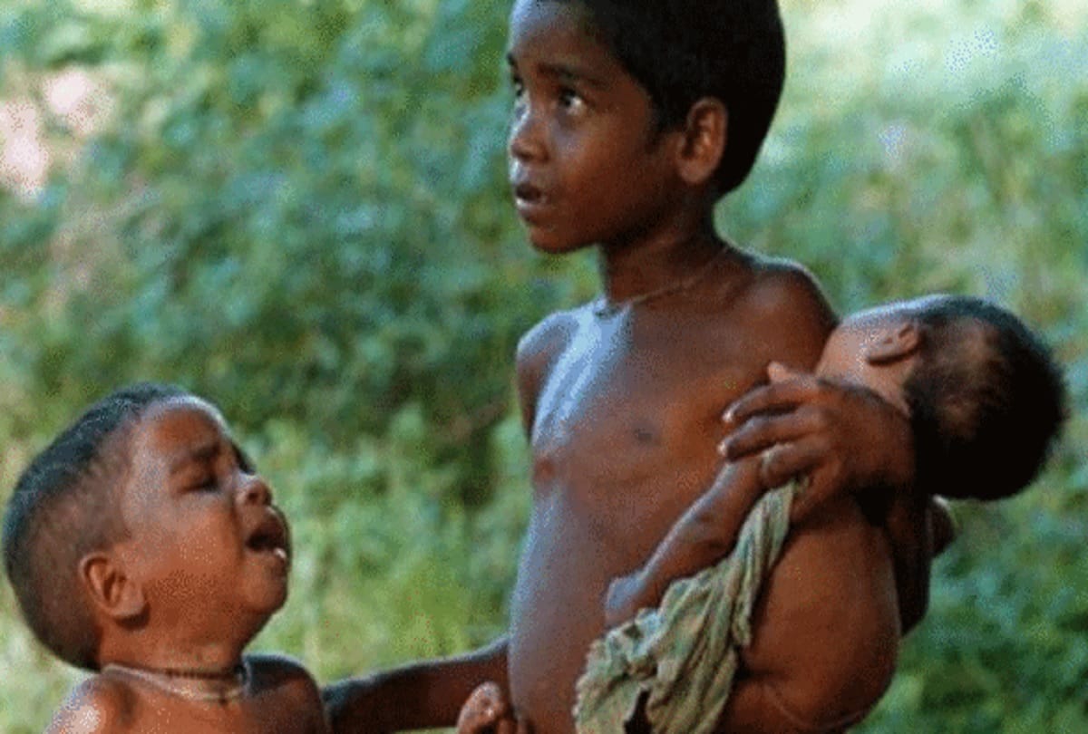uttar pradesh Hardoi six month old shagun face remember Malnutrition of Kalahandi
