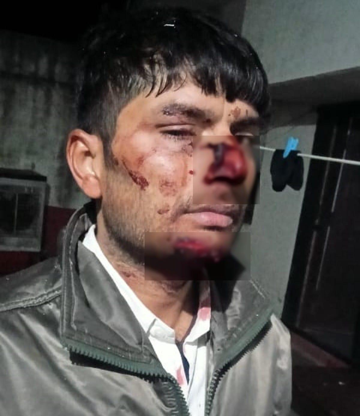Cousin brother-in-law attacked stabbed young man in night arrested azamgarh up