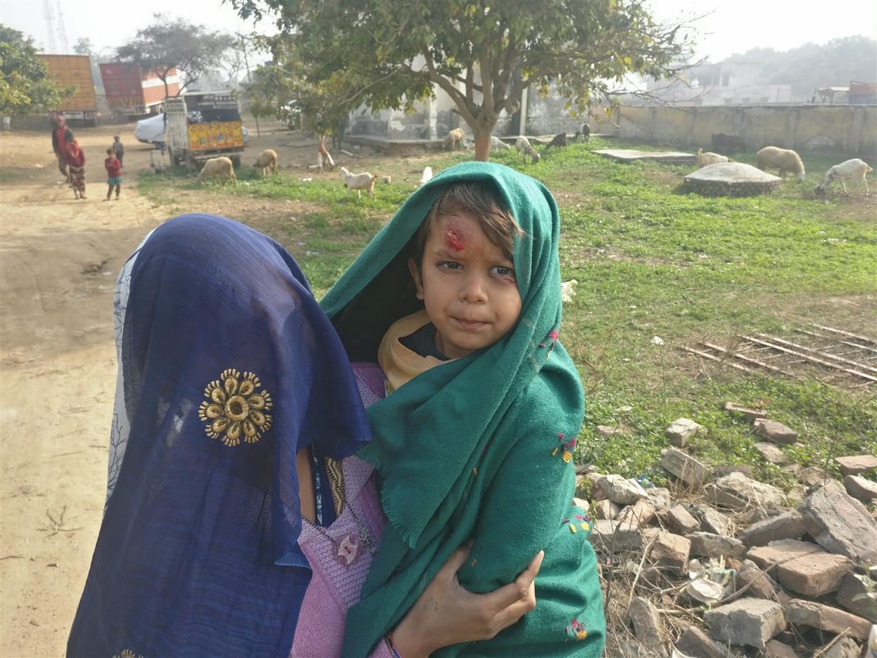 Hathras: Girl injured by bike grip