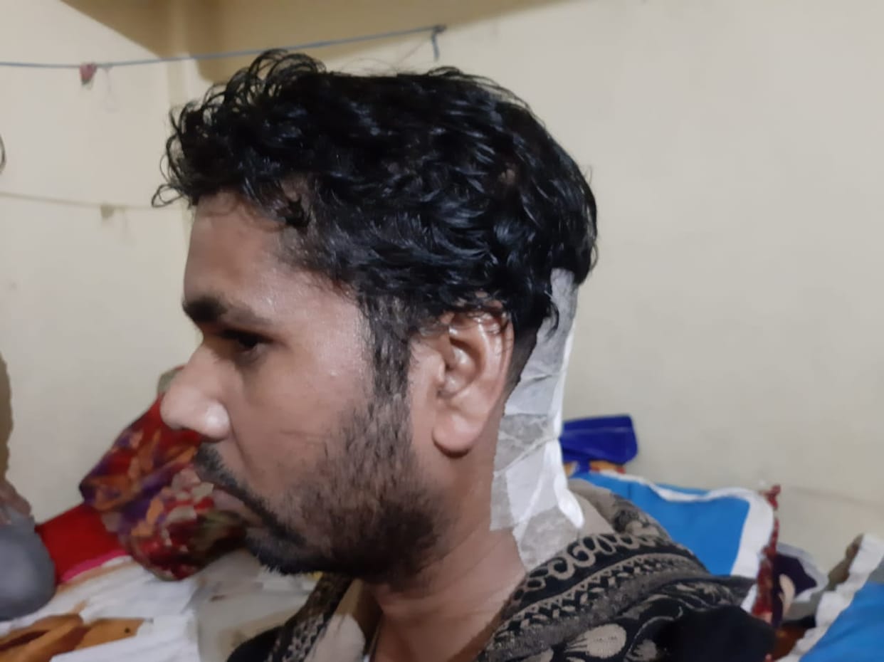 The bullet was shot in the head doctor of the government hospital told the pebble