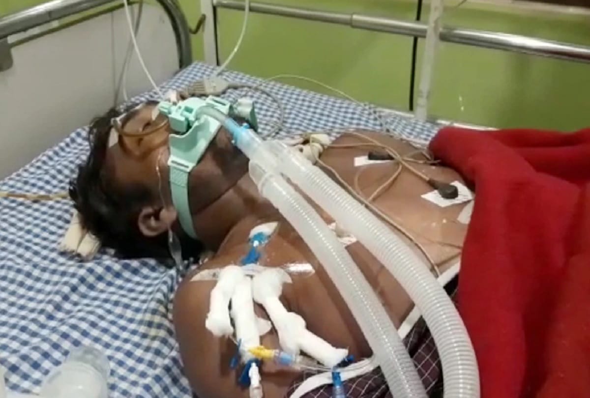 madhya pradesh katni youth filled air by compressure in his friend internal part