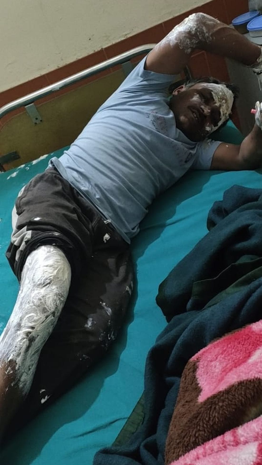 Three cattle burnt alive due to fire, young man scorched