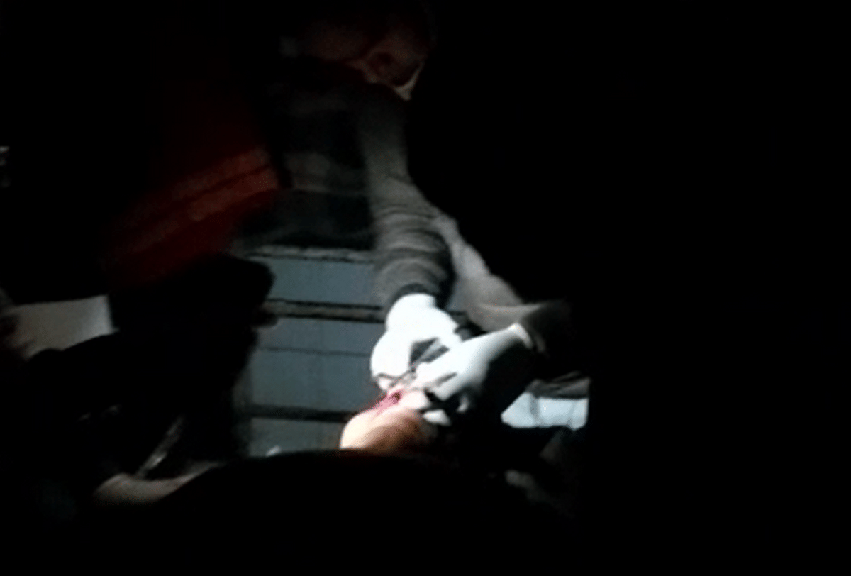 soldering under flashlight Lack of facilities treatment in mobile torch in Ballia District Hospital
