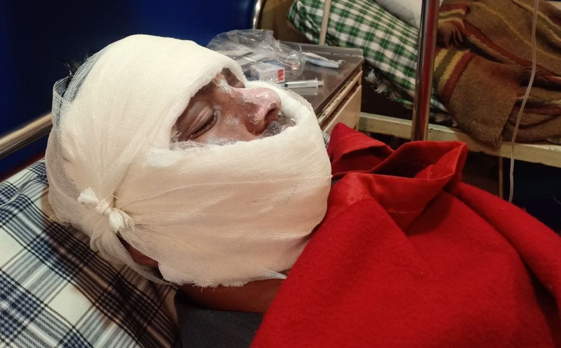 Hotel workers admitted in hospitals