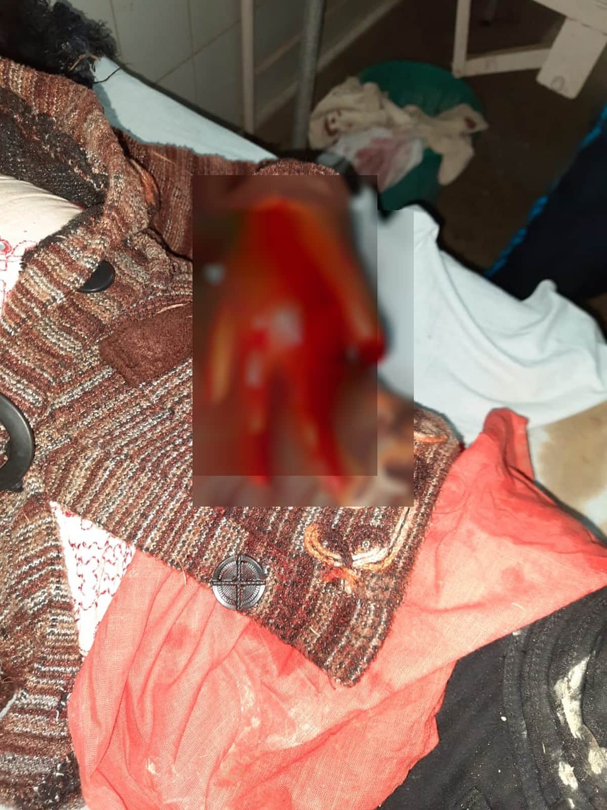 Teacher attacked girl student in unilateral love cut fingers in up ghazipur