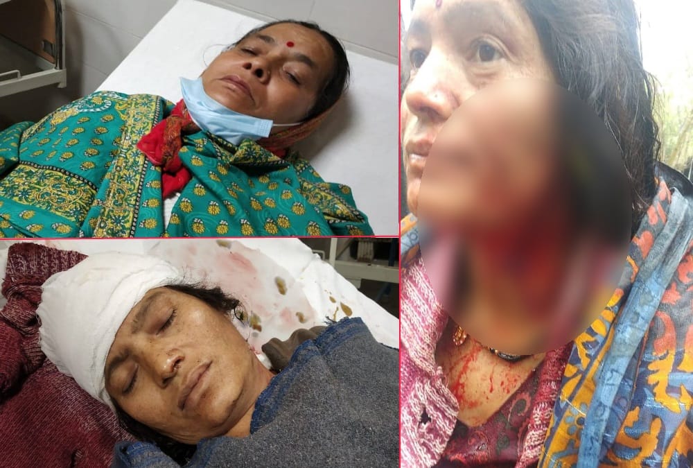 Haldwani News: Tiger attack on two women in forest during cutting grass photos