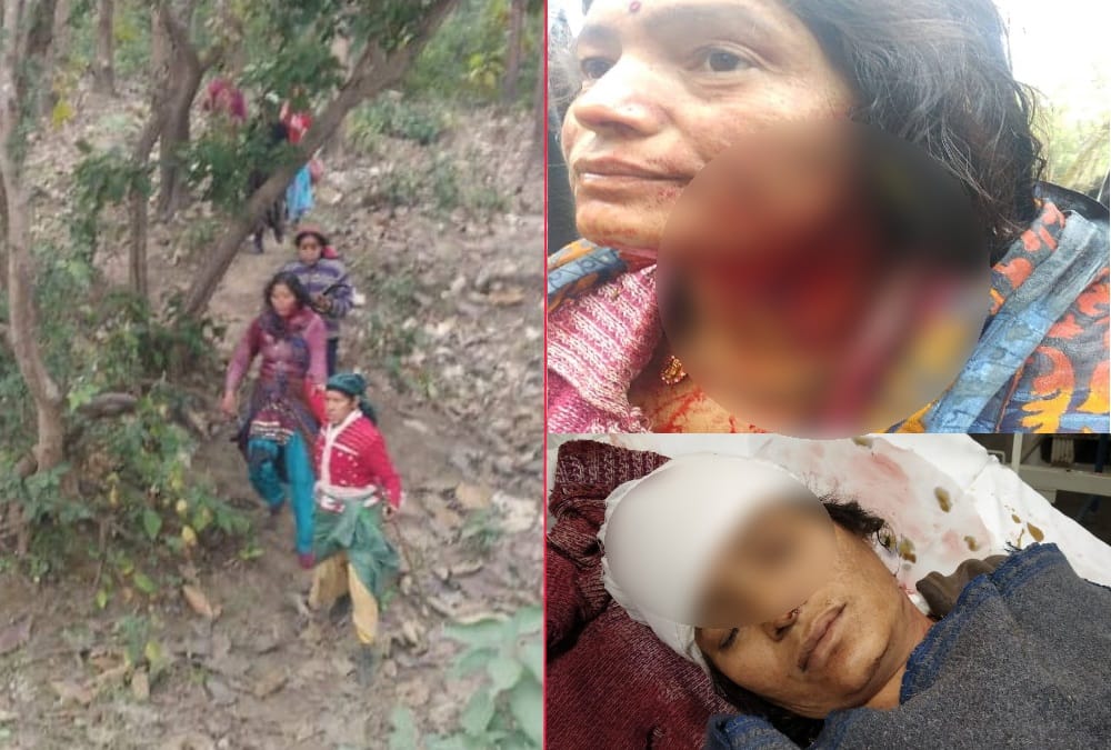 Haldwani News: Tiger attack on two women in forest during cutting grass photos