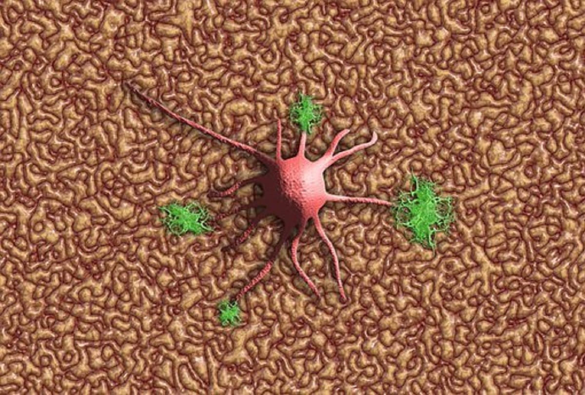 Spinal Muscular Atrophy Rare Genetic disease Causes Symptoms and Treatment