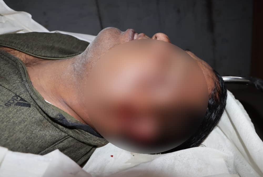 Dehradun Murder News: Property Dealer Raju Boxer was Informer of Police Many Years Ago Know his Crime History