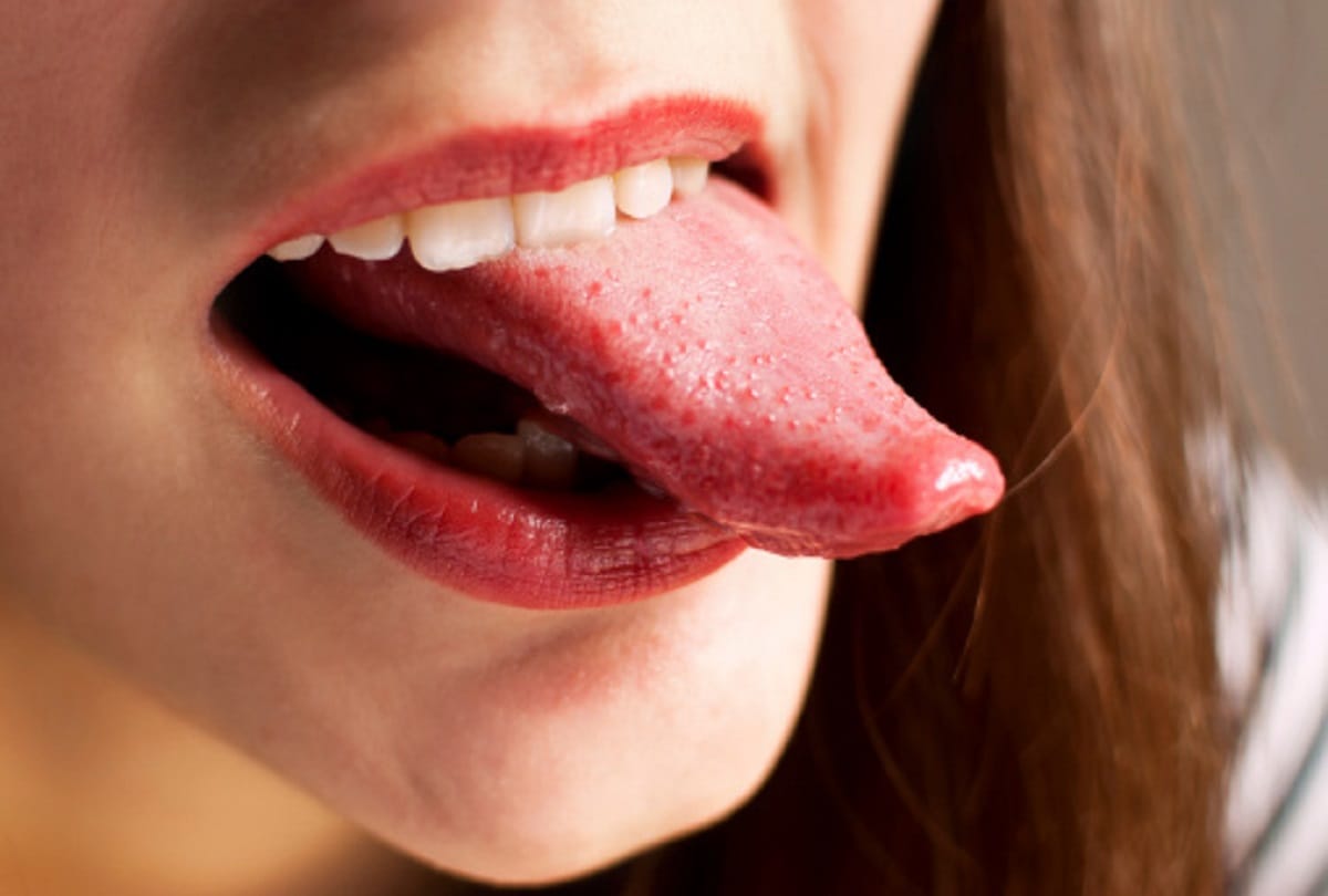 change in tongue colour means, know what expert says about this