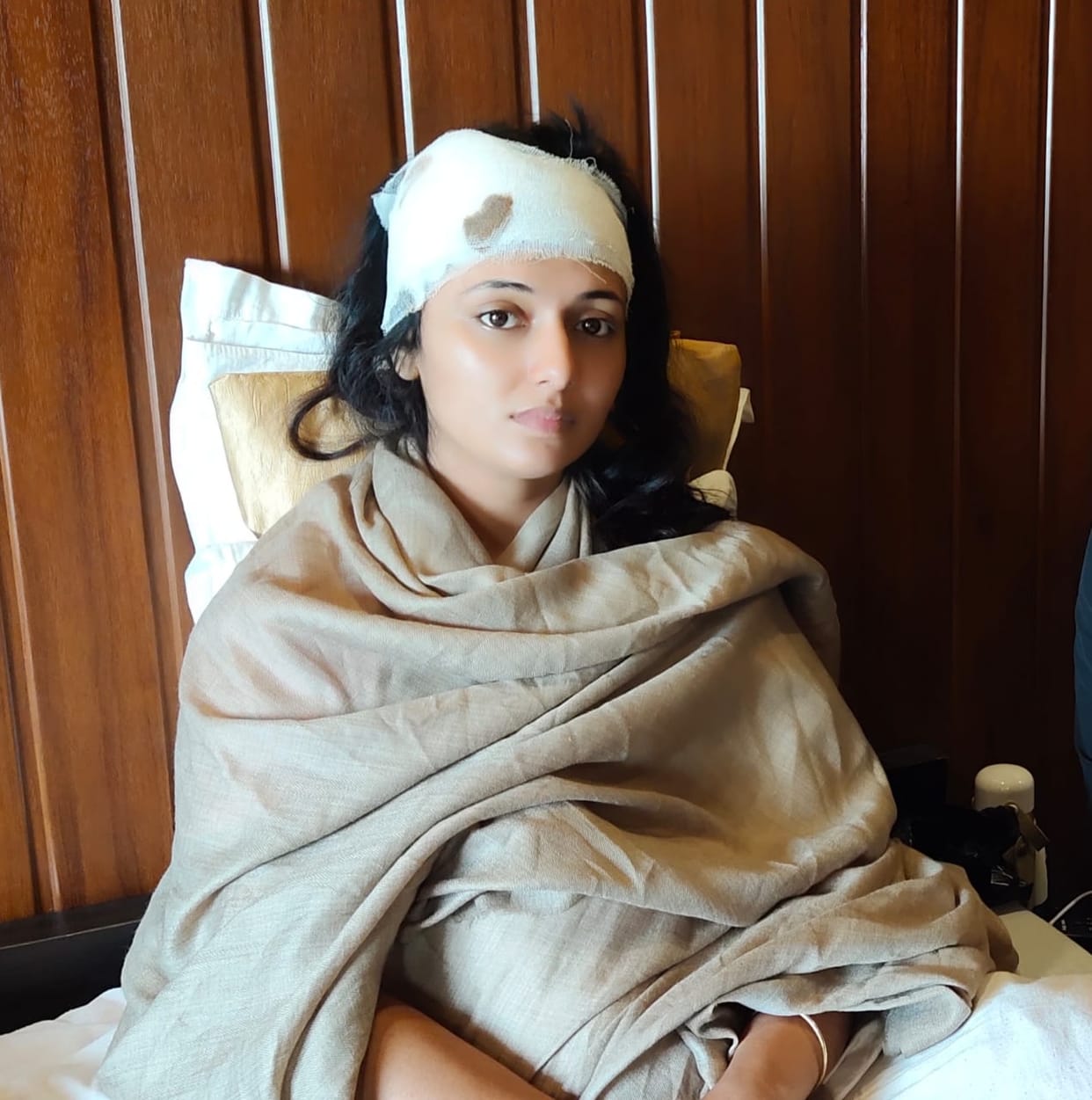 Actress injured in stone pelting during shooting of Bhojpuri film