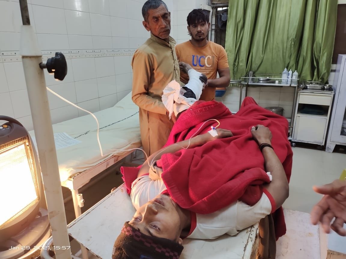 Broken leg of bike rider due to car accident