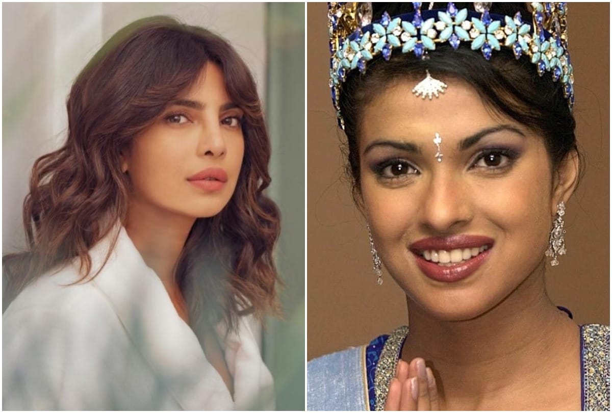 Actress before and after plastic surgery pictures see horrible changes in appearances