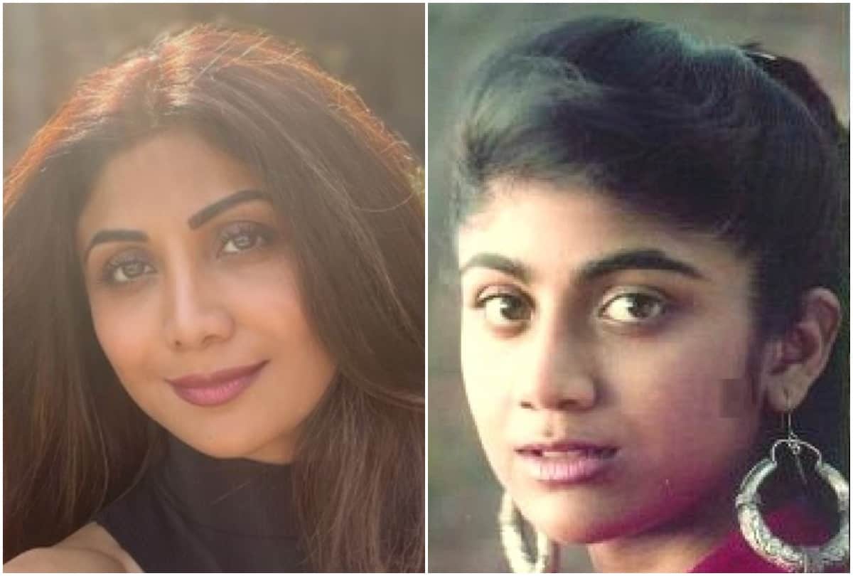 Actress before and after plastic surgery pictures see horrible changes in appearances