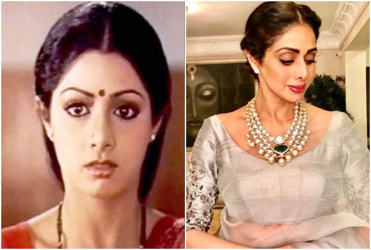 Actress before and after plastic surgery pictures see horrible changes in appearances