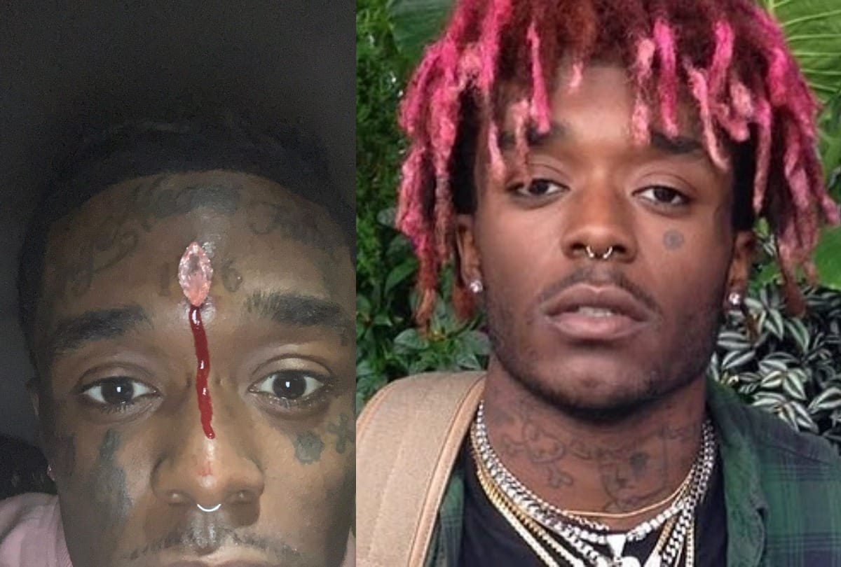 American Rapper Lil Uzi Vert Has Implanted A $24 Million Pink Diamond Into His Forehead