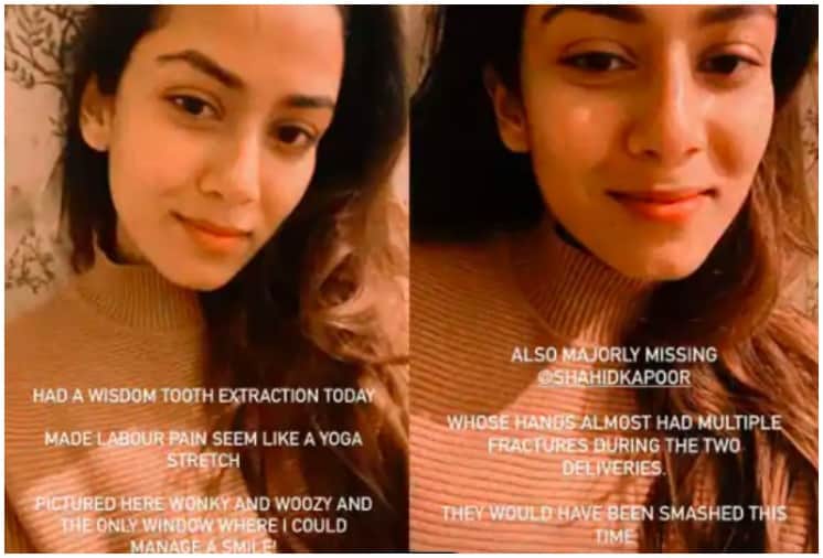 Mira Rajput Remember Husband Shahid Kapoor during Wisdom Tooth Extraction